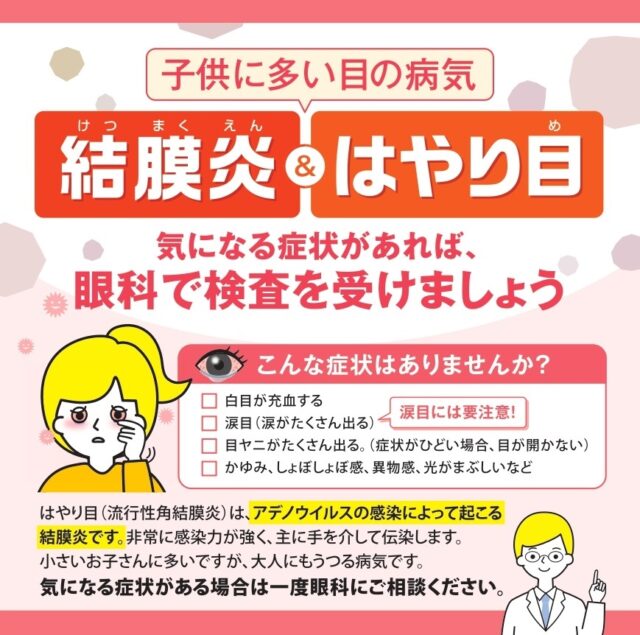 結膜炎、はやり目